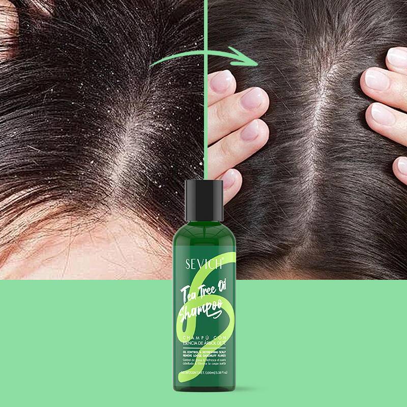 Chá árvore essência shampoo co - Hair Care Essence avaliação e preço