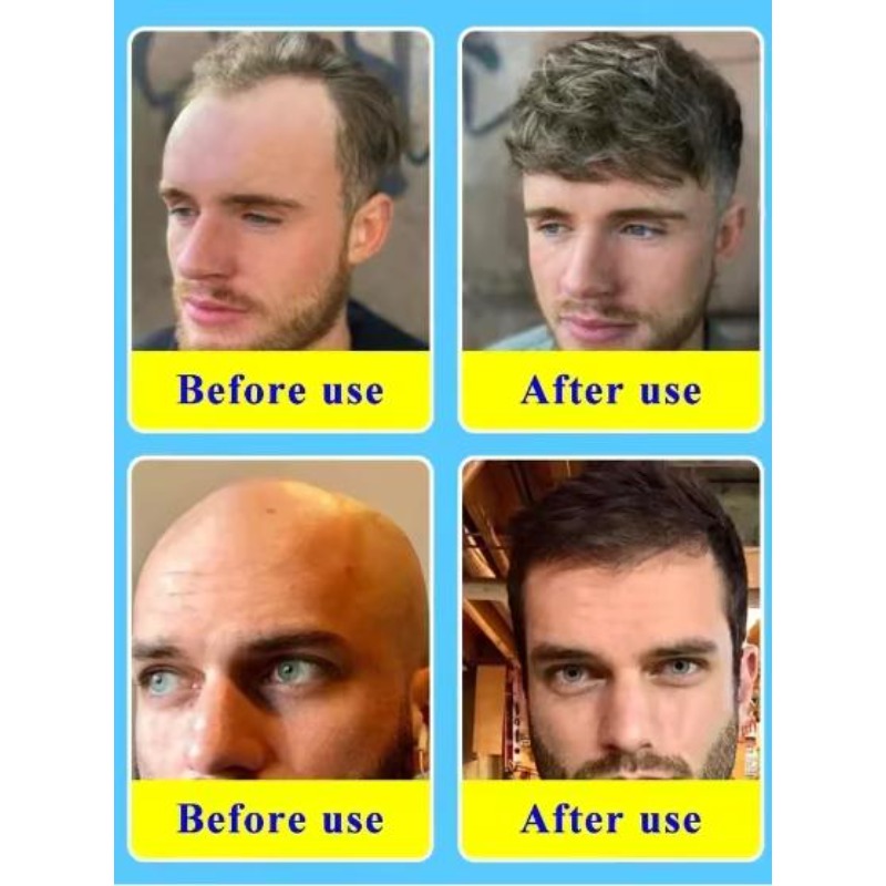Óleo Essencial de Cuidado Capi - Hair Care Collagen avaliação e preço