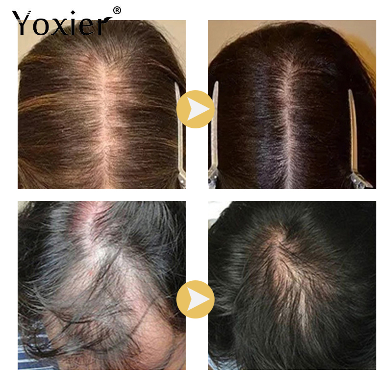 Soro de crescimento intensivo  - Hair Care Serum avaliação e preço