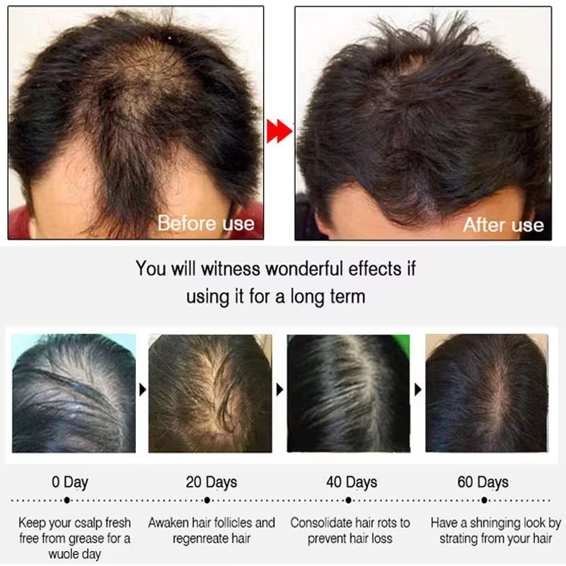 Spray de Crescimento Rápido de - Hair Care Serum avaliação e preço